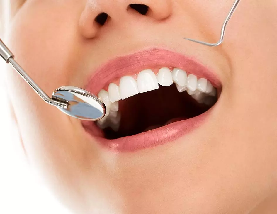 Zirkonyum ile Diş Kaplama - Özel Elit Estetik Ağız ve Diş Sağlığı Polikliniği